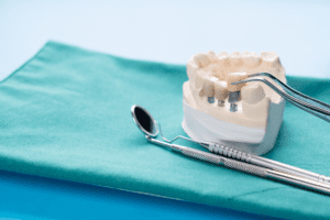 dental implants Madison Ave Dental dentist in Greenwood, IN