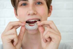 Child fitting a protective mouthguard over their teeth