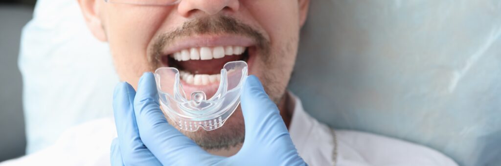 Man holding a protective mouthguard near his teeth