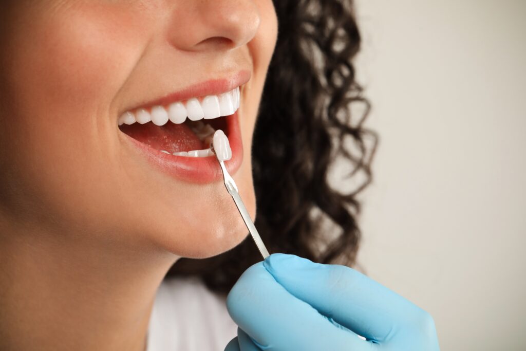 Dental mirror beside a patient’s smile