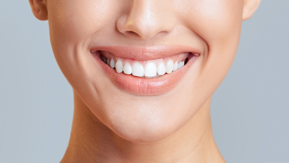 Close-up of a smile showing the front teeth